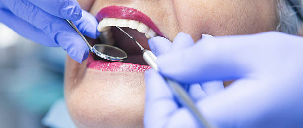 Best Broken or Chipped Tooth Repair in Rochester, WI